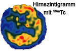 Radiochemie